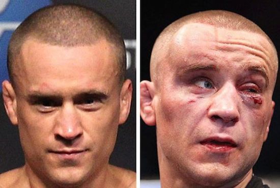 MMA Before And After 3