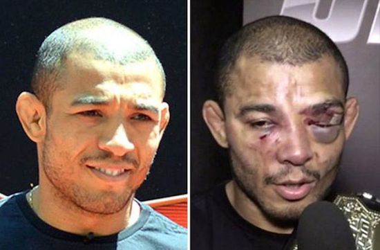 MMA Before And After 4
