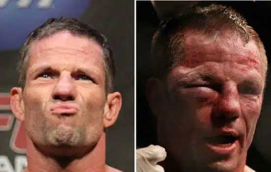 MMA Before And After 6
