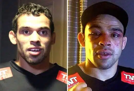 MMA Before And After 8