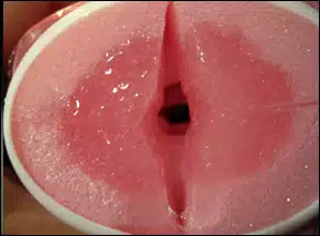 can