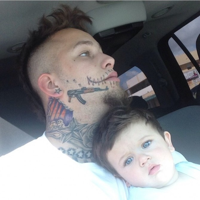 Stitches With His Son