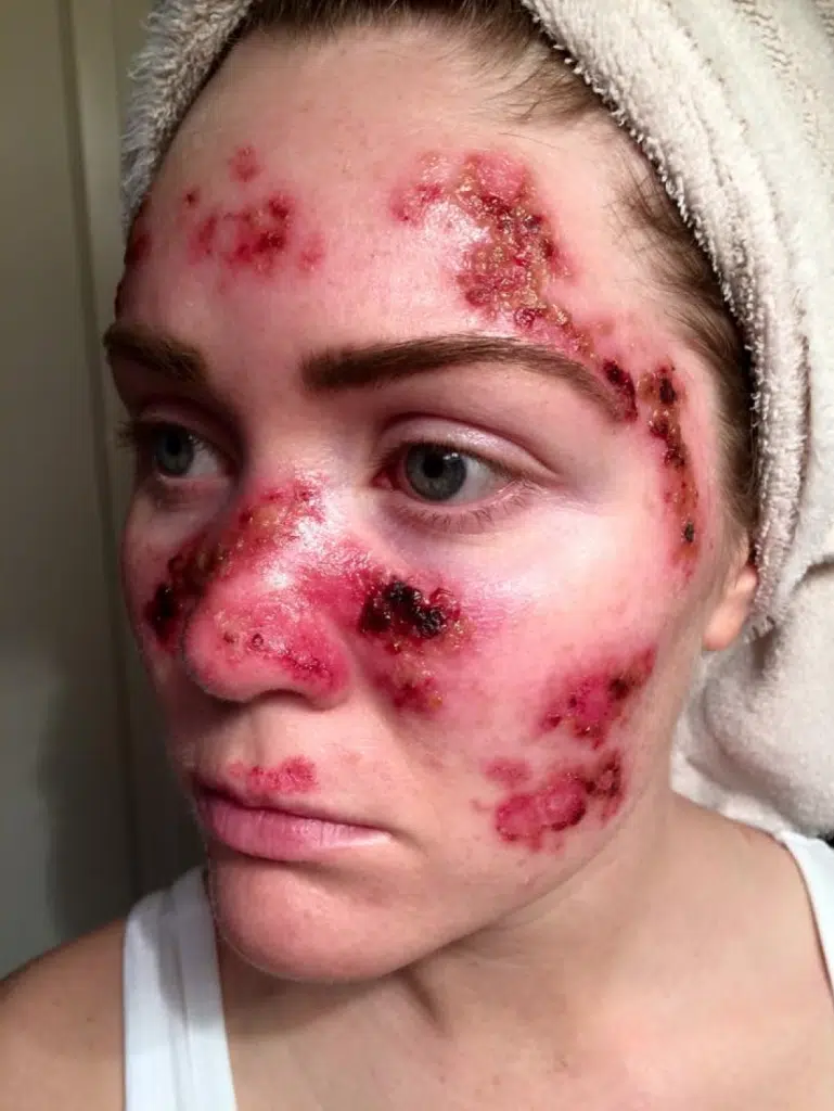 SKin Selfie