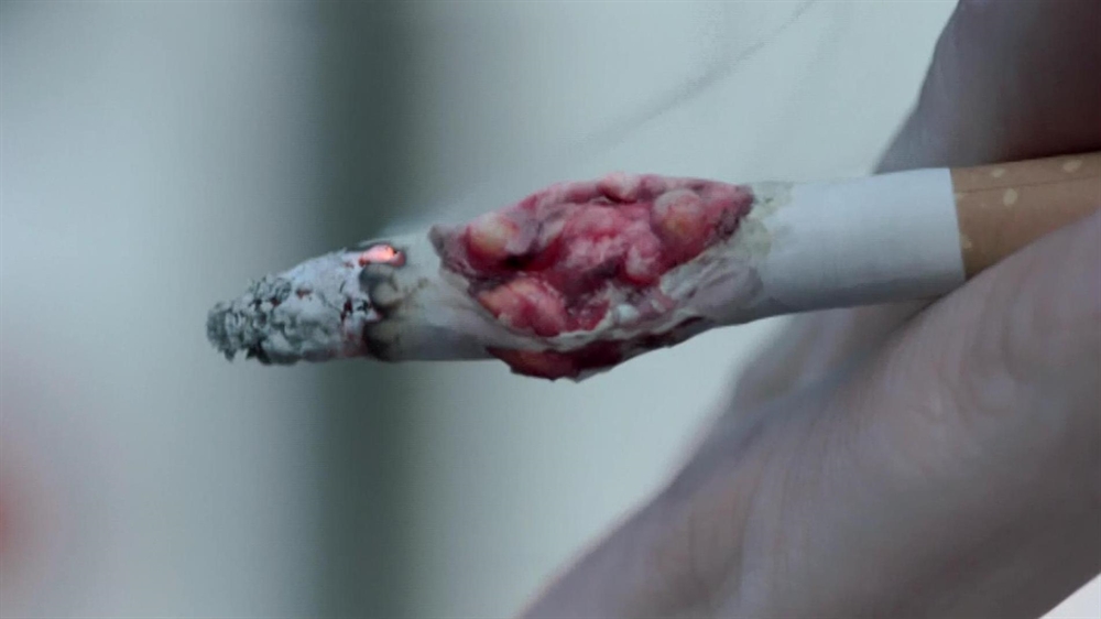 Smoking Sucks - Anti-Smoking Advert