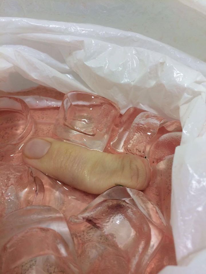 Finger On Ice
