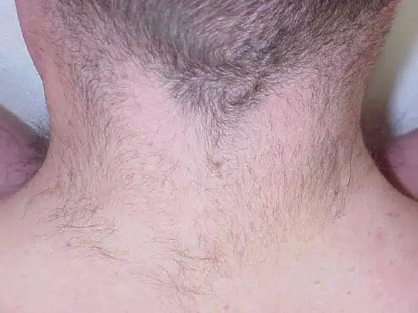 neck