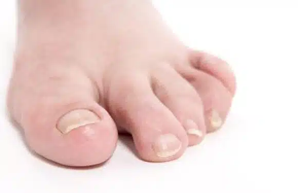 foot