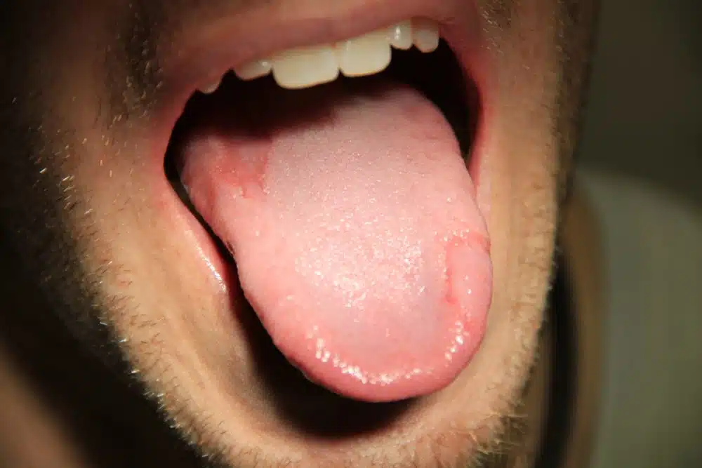 Tongue