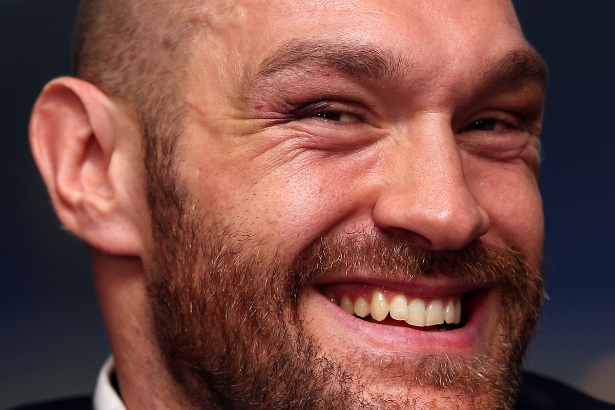 Tyson Fury’s Attempt To Prove His Strength Was A Complete Flop (VIDEO