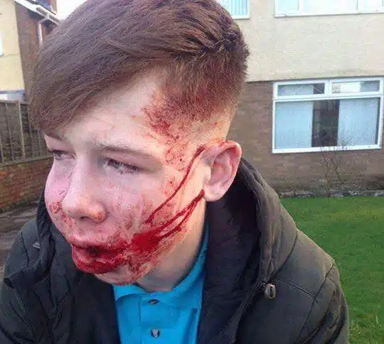 Bullied teen 2