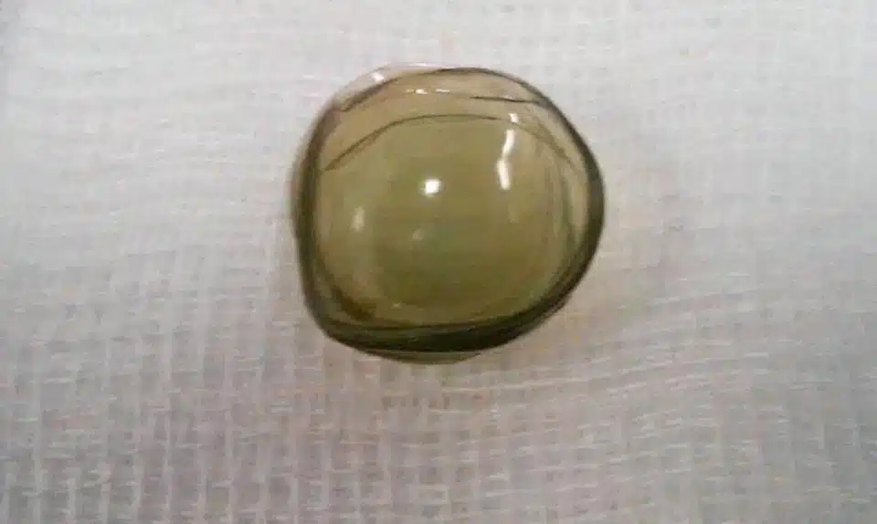 Contact lenses