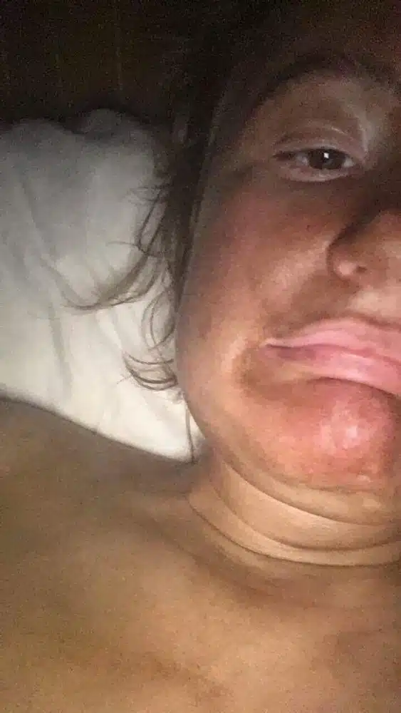 MORTIFIED MUM HOUSEBOUND FOR WEEK AFTER LEFT LOOKING LIKE CHOCOLATE SPREAD