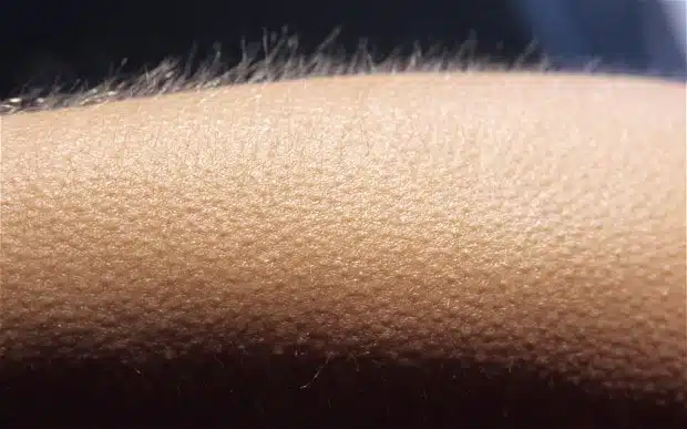 Goosebumps