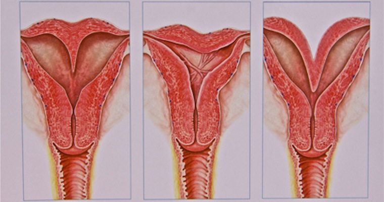 Vaginas pics with 2 woman 
