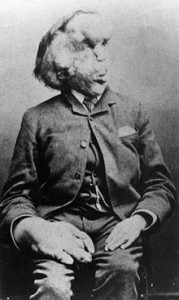 Joseph Merrick - Elephant Man