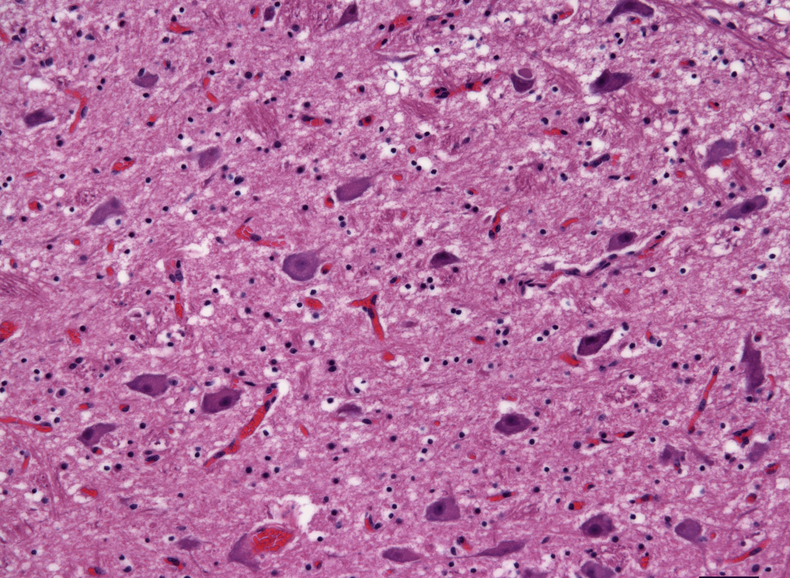 Healthy Cow Brain