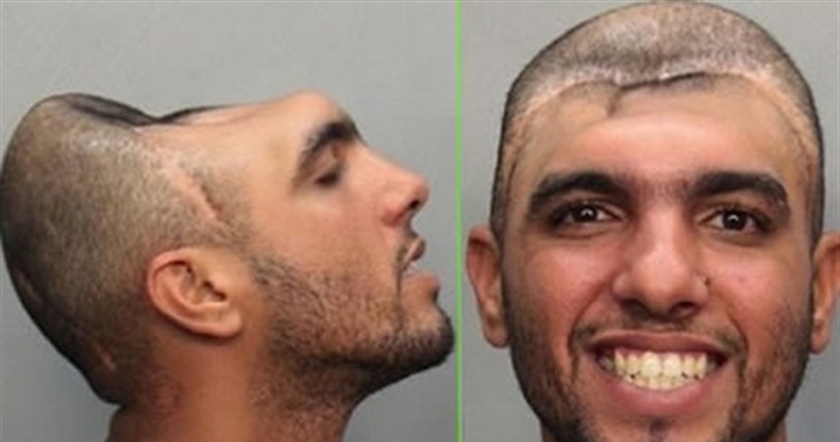 Mugshot - Freaks - Half A Head - Halfy