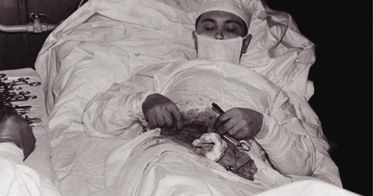 Leonid Rogozov - appendectomy