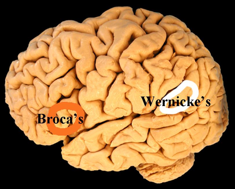 Broca and Wernicke Speech Areas