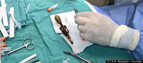 Ataxcama Humanoid Alien - Sirius - Surgery