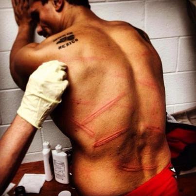 ALBERTO DEL RIO INJURY