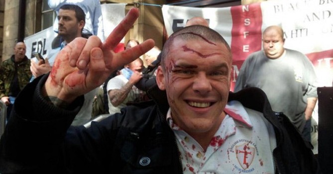 EDL man covered in blood