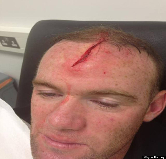 ROONEY CUT