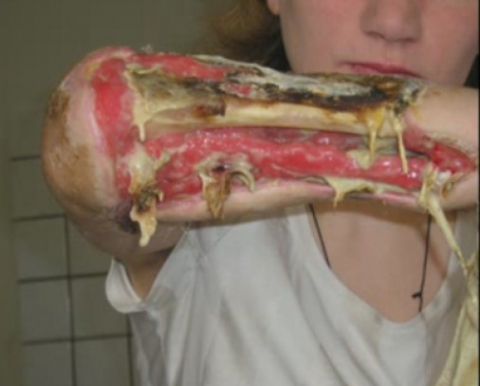 krokodil 6