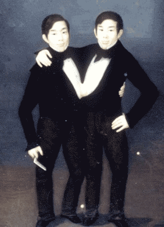 Chang Eng Bunker - Siamese Twins - French Painting 1835