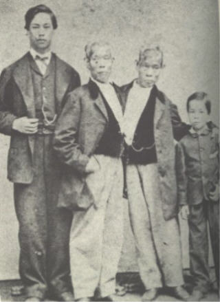Chang Eng Bunker - Siamese Twins - With Sons