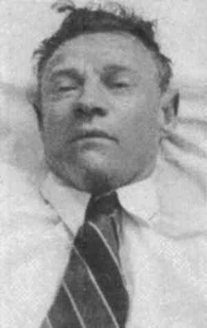 The Somerton Man - Taman Shud - The body