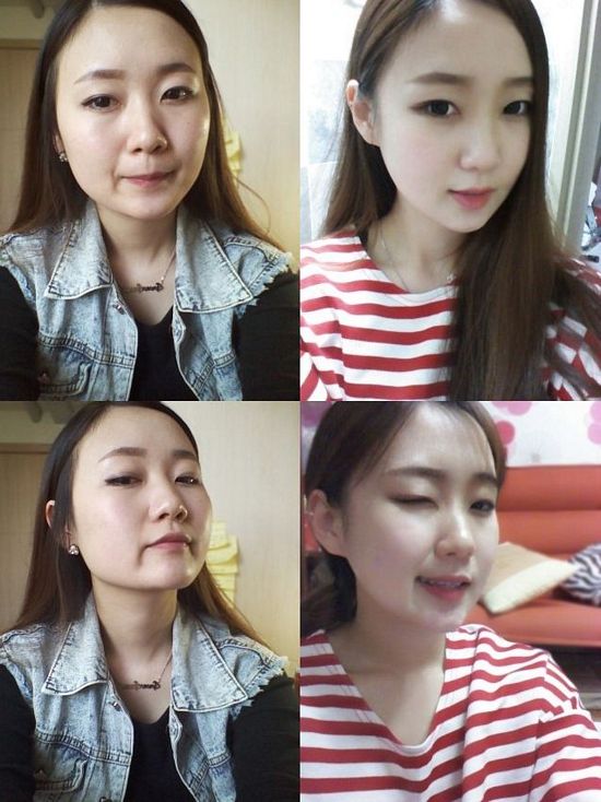 Crazy Before And After Photos Of South Korean Plastic Surgery Page 5 