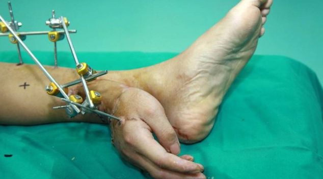 Severed Hand Ankle Featured