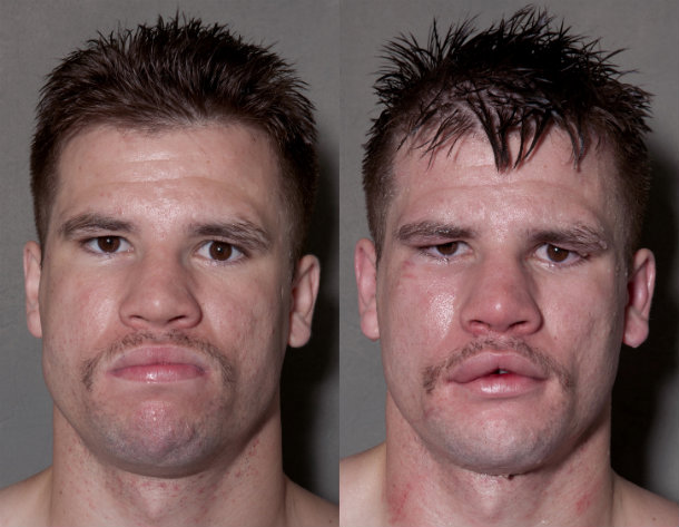 boxer before after fight