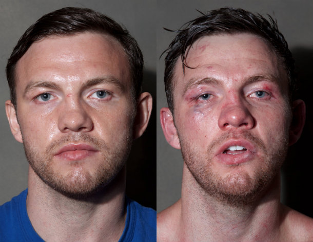 boxer injuries