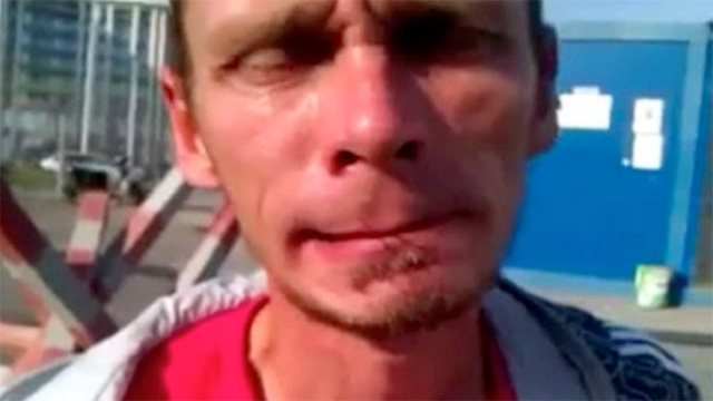 Sochi worker with mouth sewn shut