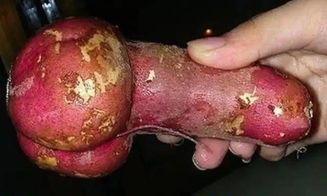 PHOTOS: Potatoes Shaped Like Penises