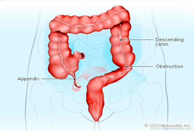 Appendix