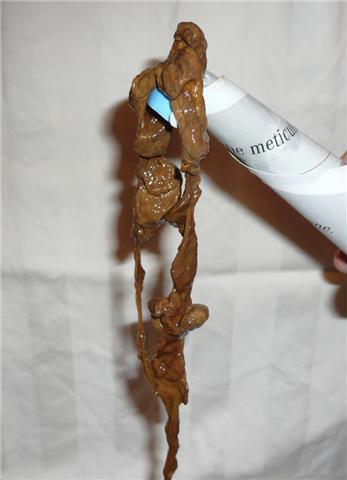Colonic Irrigation - what is 3