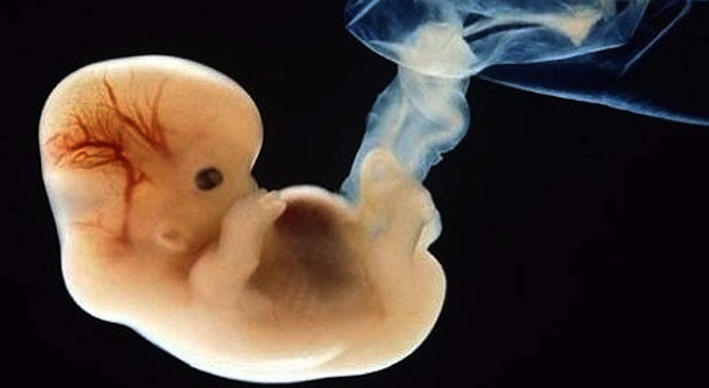 Prenatal Photos Featured