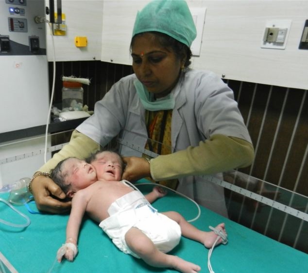 Weird News - hikha Malik two heads baby India 2