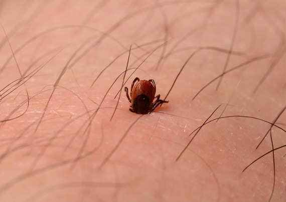 Wellcome Image Awards - Tick sucking blood from human leg