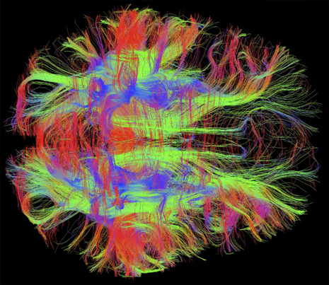 Wellcome Image Awards - Wiring of the human brain