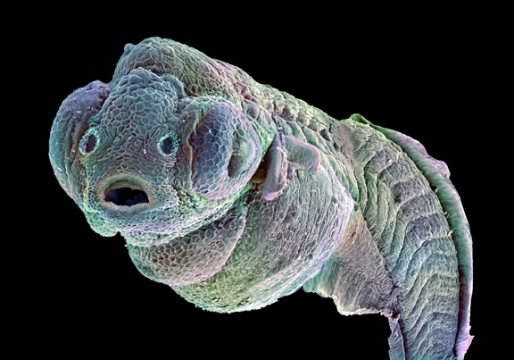Wellcome Image Awards - Zebrafish embryo