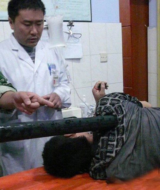 Weird News - Mr Li Impaled 3