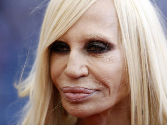 Plastic Surgery Gone Wrong 15