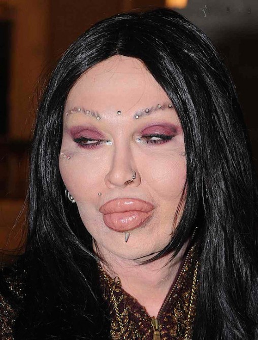 Plastic Surgery Gone Wrong 5