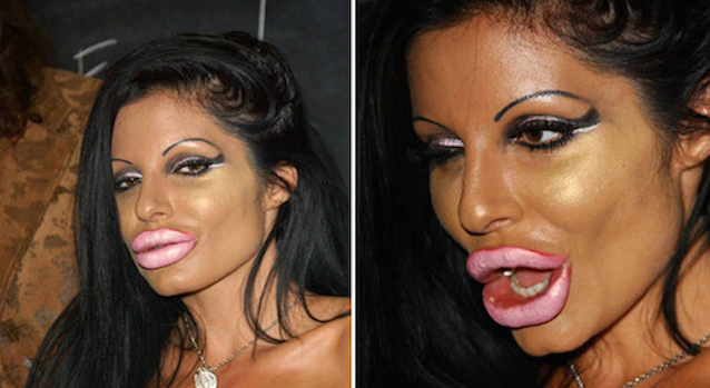 Plastic Surgery Gone Wrong Featured