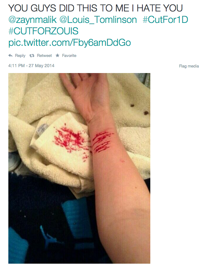 one direction fans cut themselves