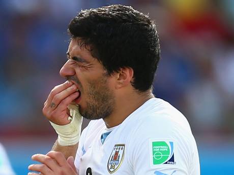 suarez bite 2